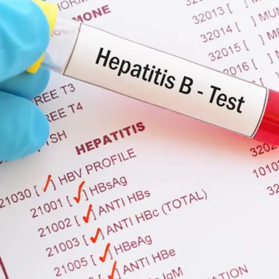 Hepatitis B Virus Causes, Symptoms, and Prevention Measures